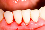 periodontia